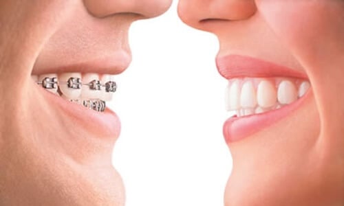 Orthodontic Dentistry in Eaglerock
